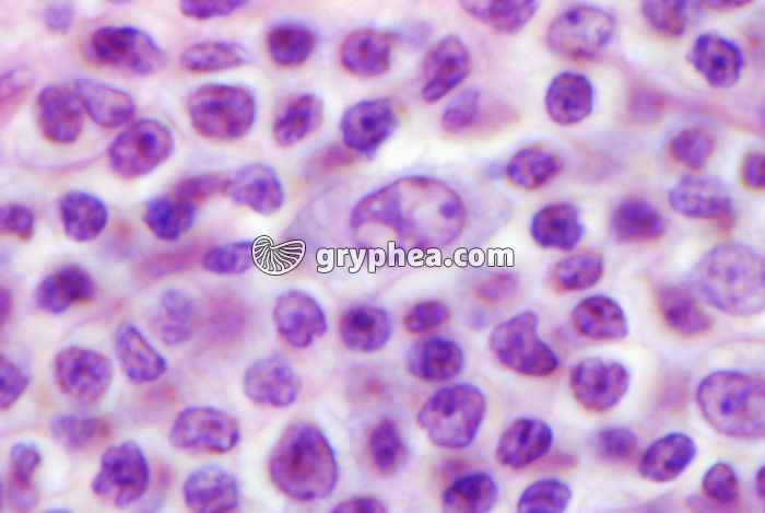 Ganglion lymphatique x800 - gryphea.org